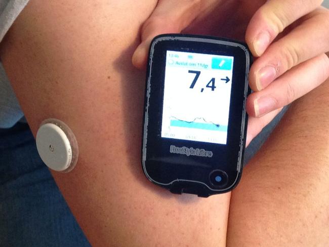 continous glucose monitor